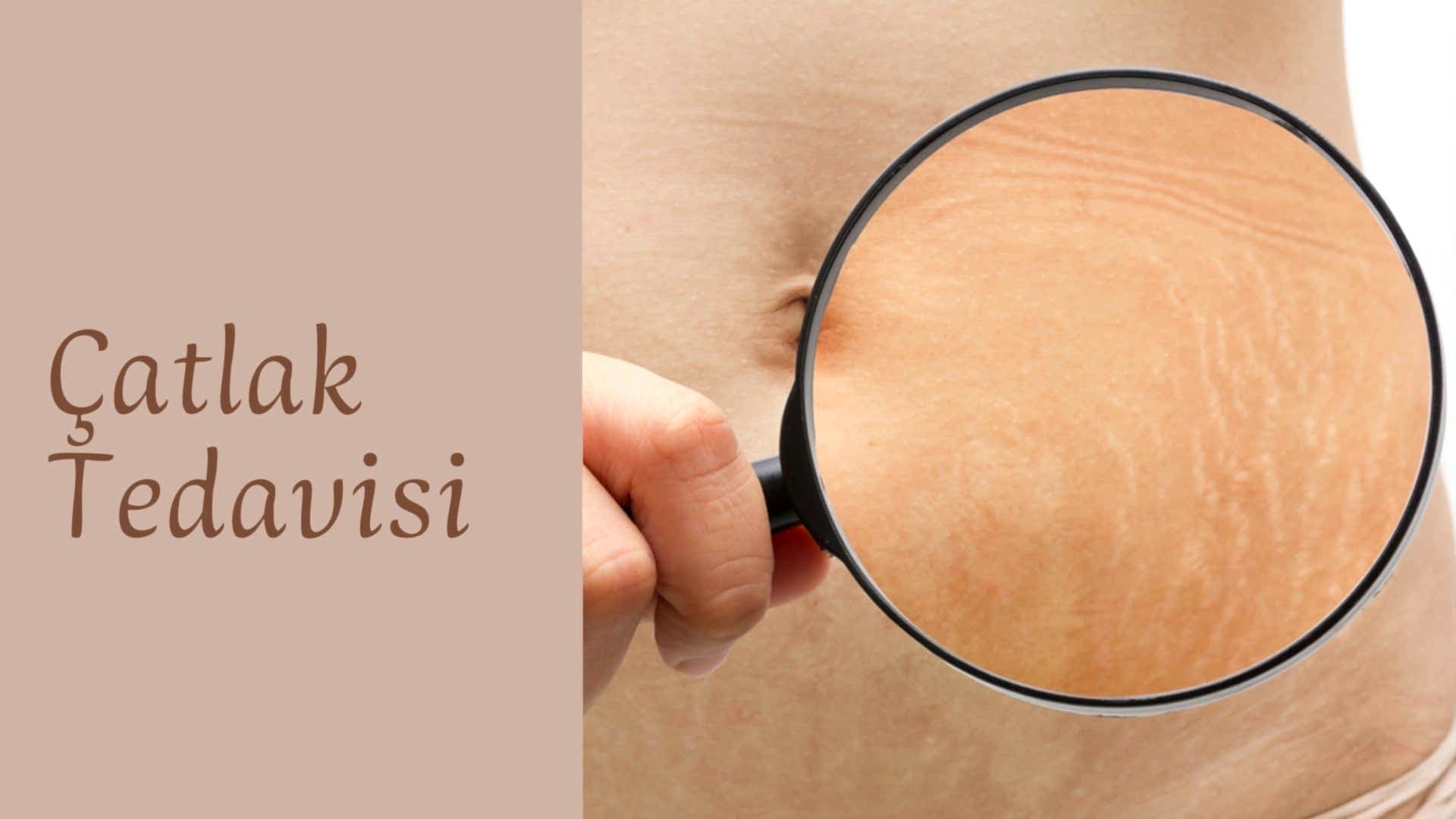 ankara-catlak-tedavisi