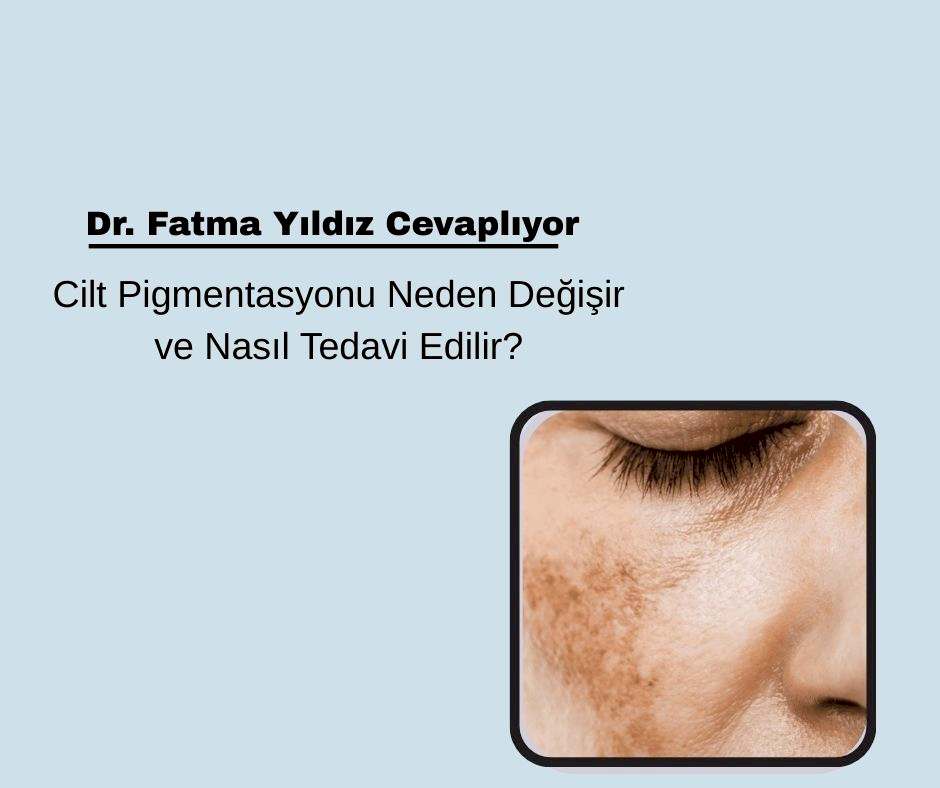Cilt Pigmentasyonu Neden Değişir ve Nasıl Tedavi Edilir?