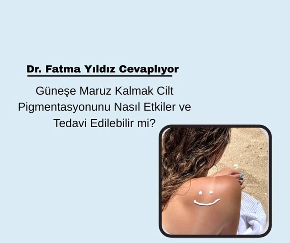 Güneşe Maruz Kalmak Cilt Pigmentasyonunu Nasıl Etkiler ve Tedavi Edilebilir mi?