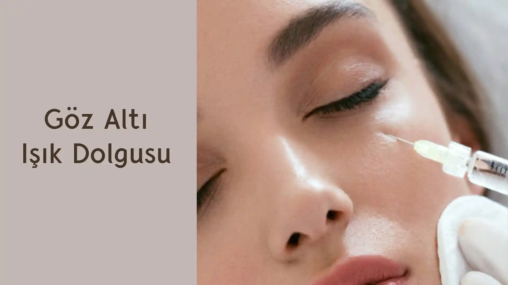 ankara goz alti isik dolgusu
