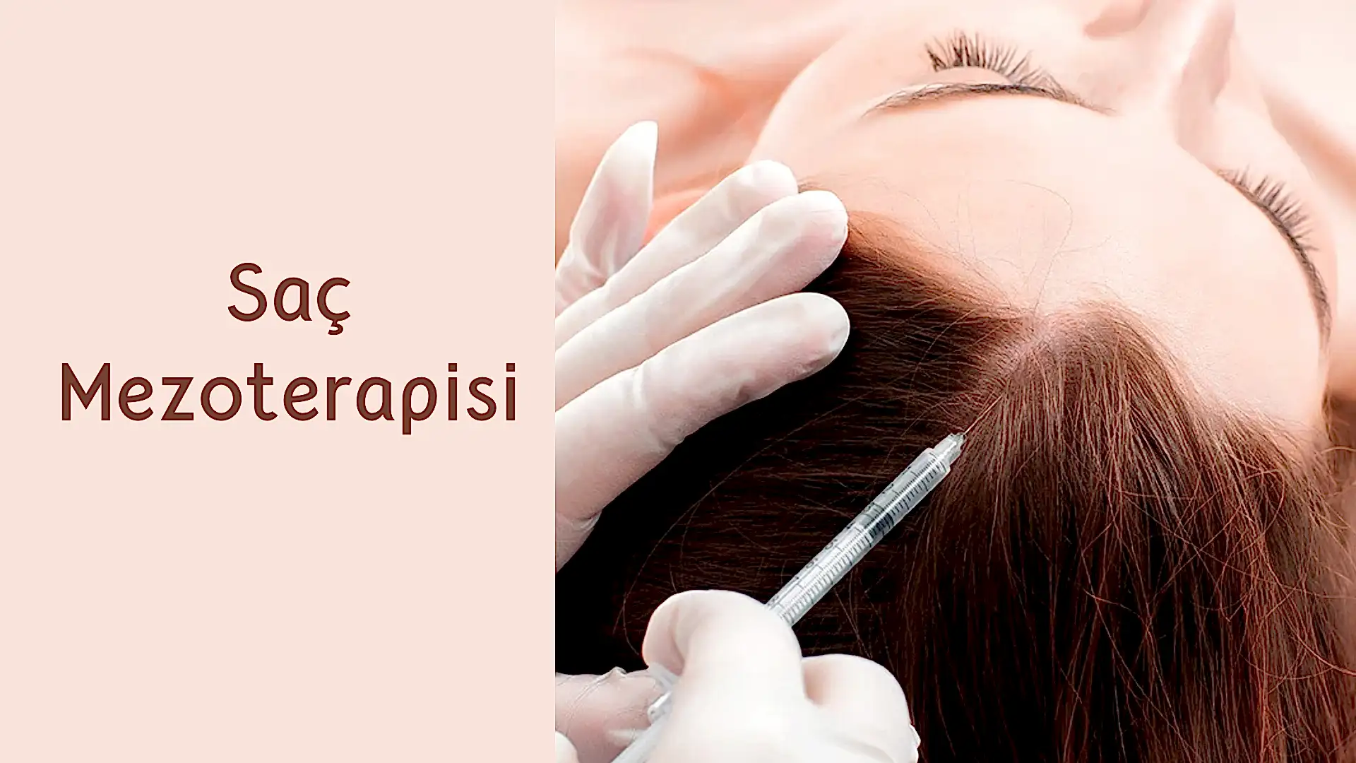 ankara sac mezoterapisi